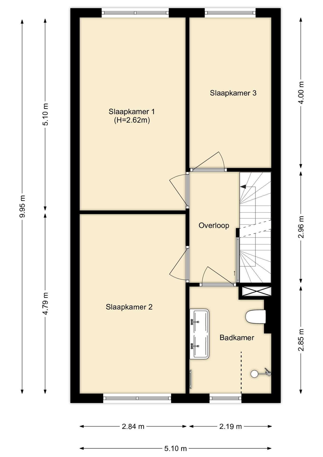 Photo 40 of Fibula 43