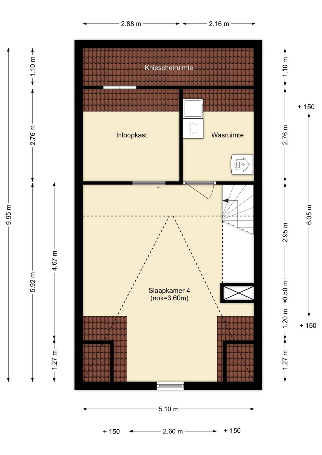 Photo 41 of Fibula 43